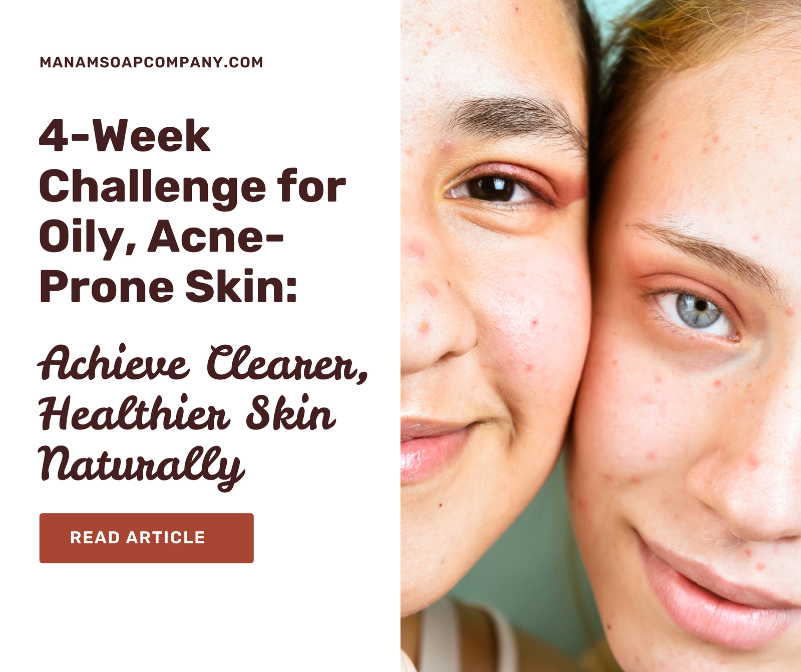 4-week skincare challenge for oily, acne-prone skin